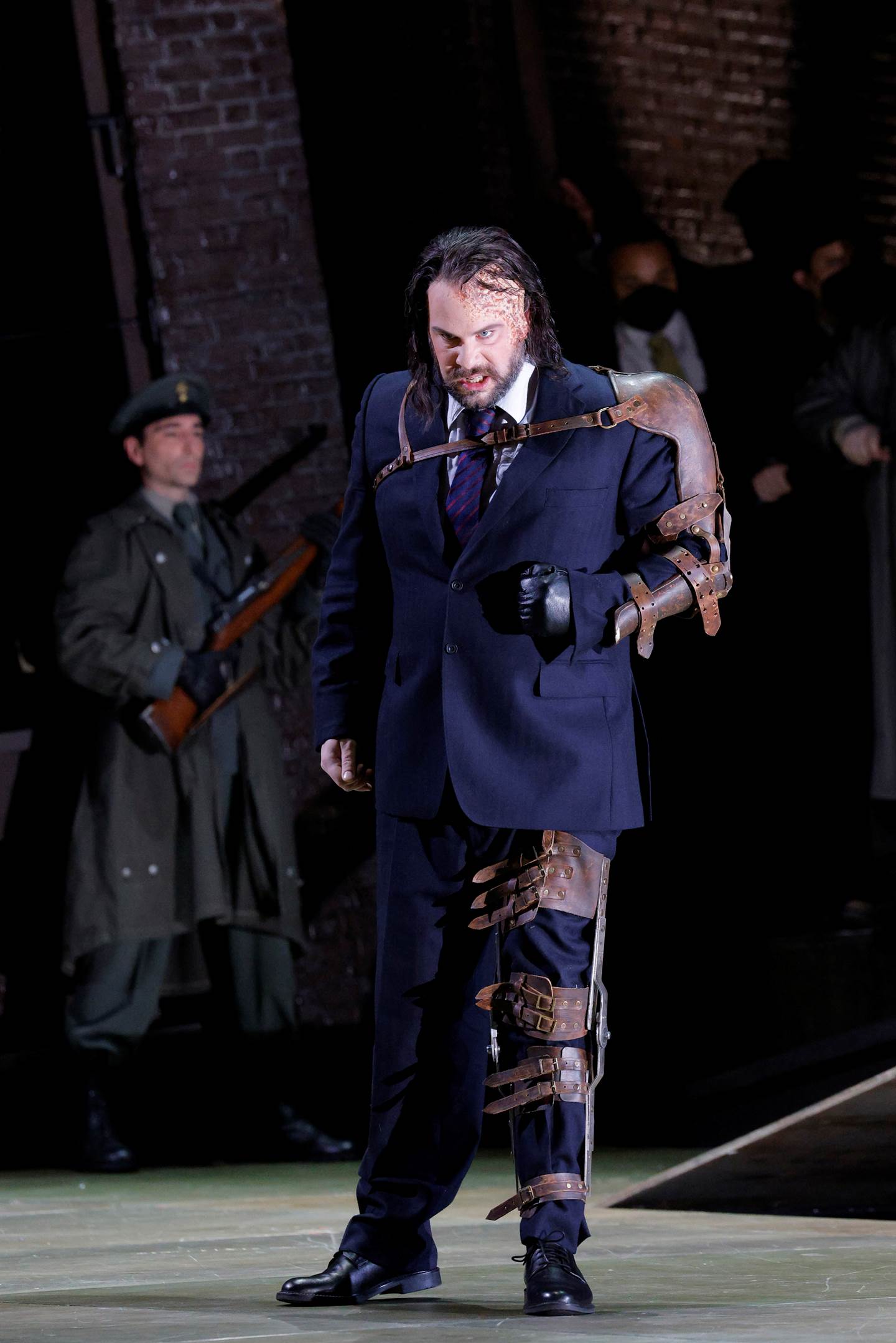 man with disfigured left side looking angry