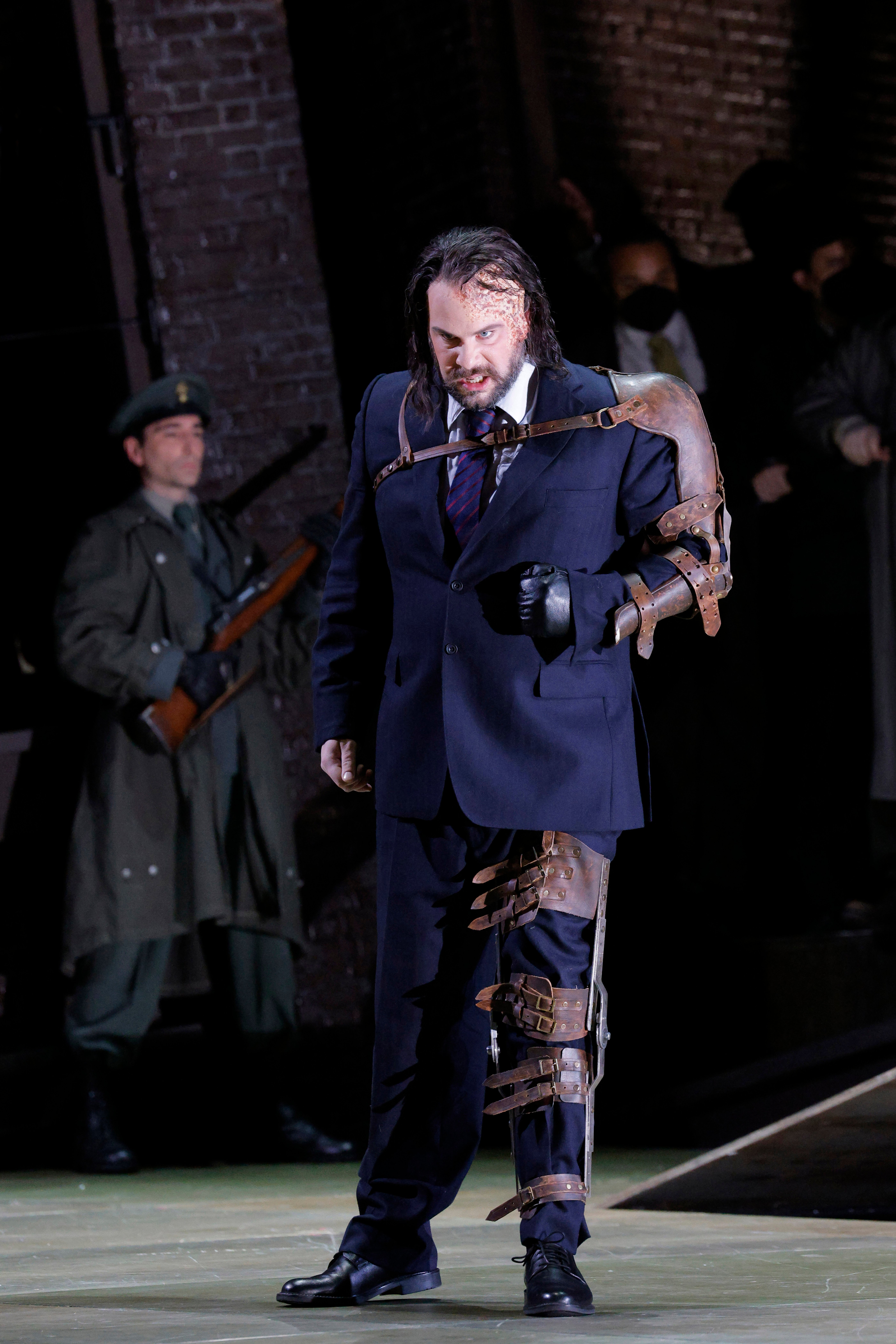 man with disfigured left side looking angry